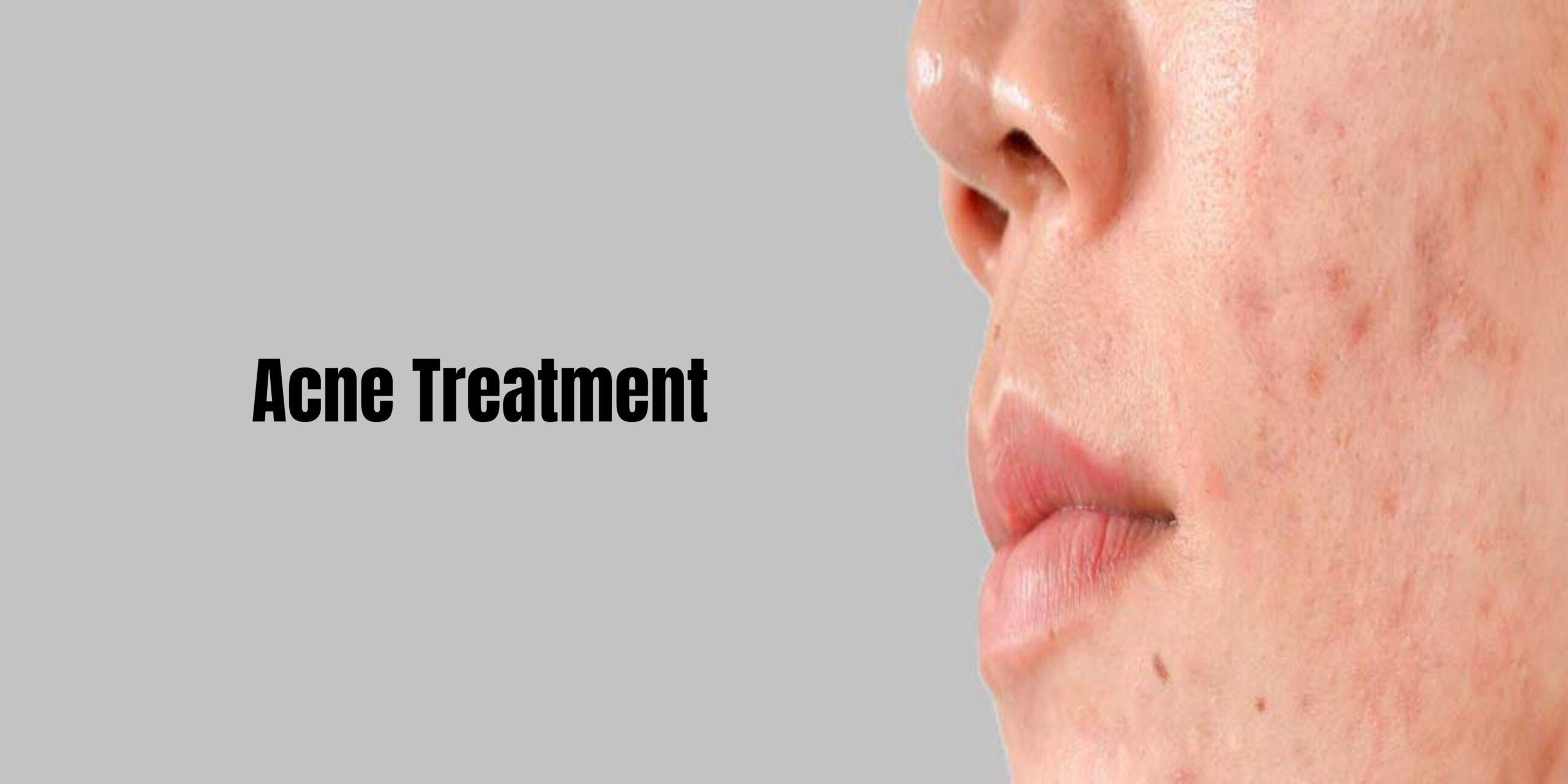 3 Most Popular Medical Aesthetic Procedures