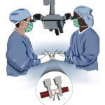 Global Microsurgery Market Size, Forecasts to 2032