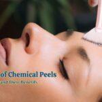 Types of Chemical Peels and Their Benefits