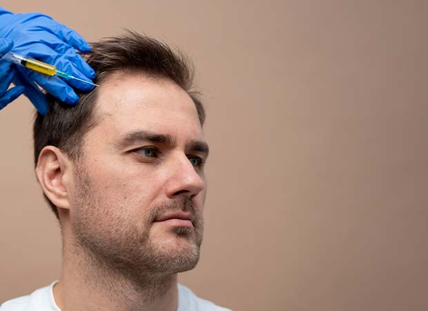 6 Things to Expect After Hair Transplant