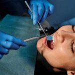 Revitalizing Smiles Through Expert Dental Bridge Services