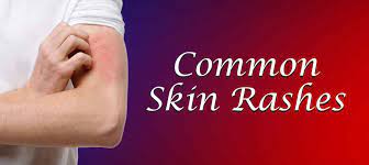 What are the causes and solutions of skin rashes?